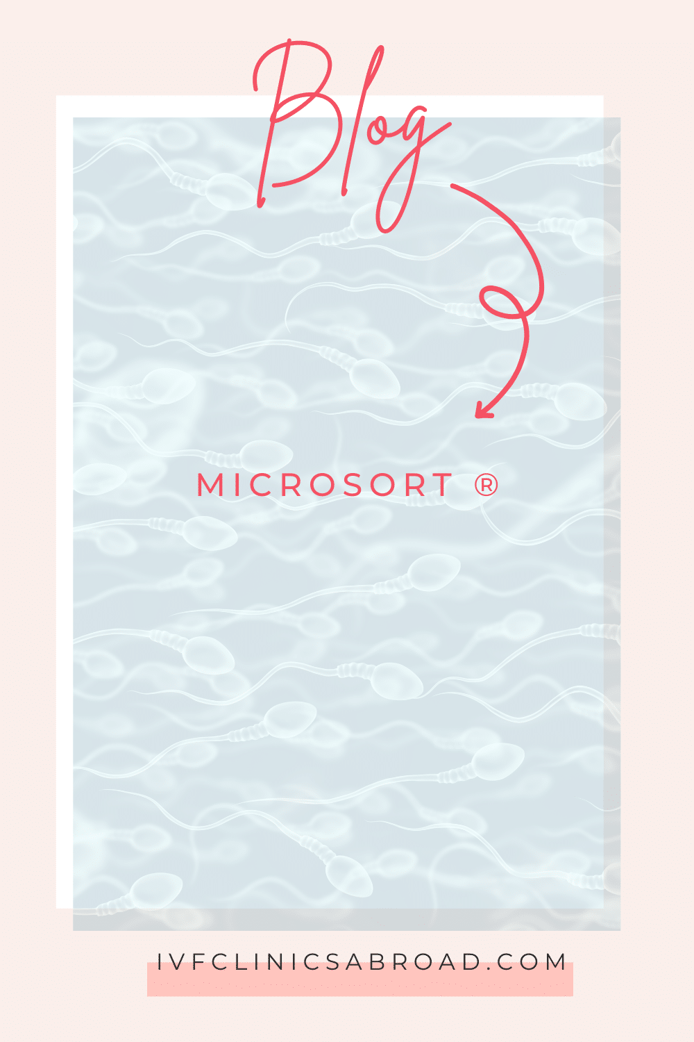 MicroSort Gender Selection: How sperm sorting with MicroSort® and IUI ...