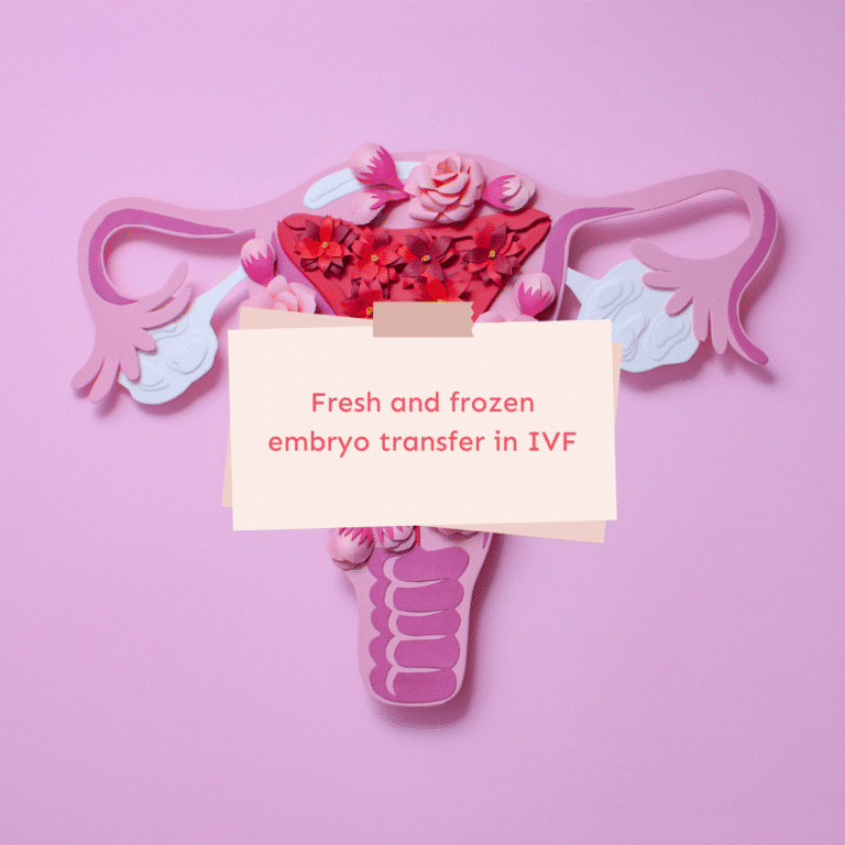 Fresh and frozen embryo transfer in IVF