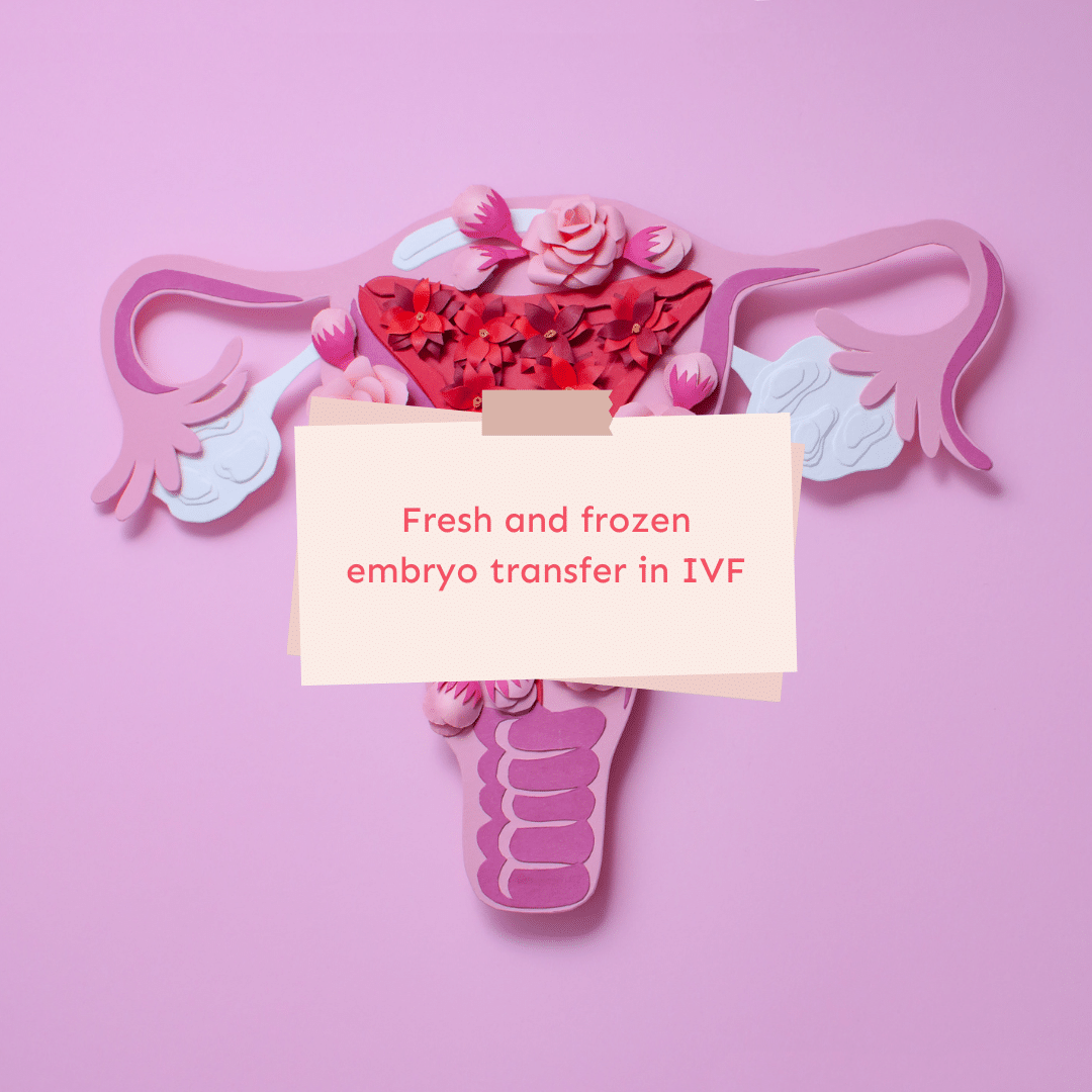 Fresh and frozen embryo transfer in IVF