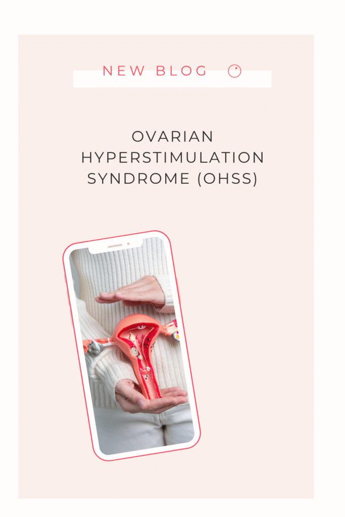 Syndrome d'hyperstimulation ovarienne (SHO)