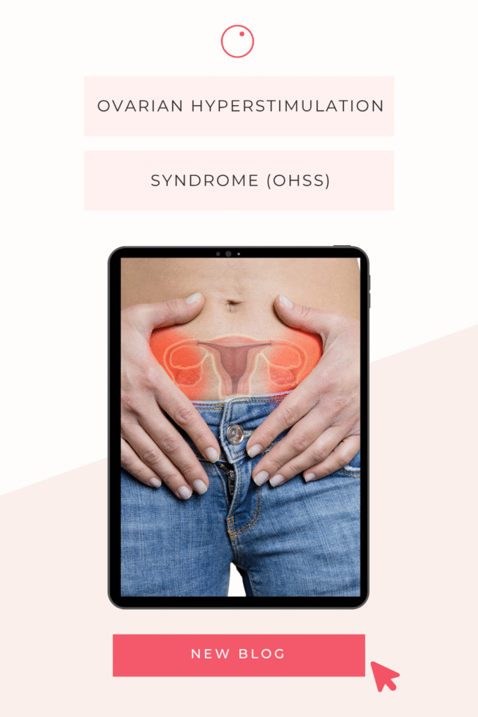 Syndrome d'hyperstimulation ovarienne (SHO)