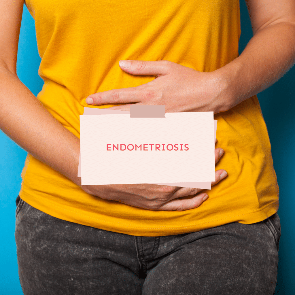 IVF with Endometriosis: Understanding Fertility Challenges and Real Success Rates 2 Endometriosis
