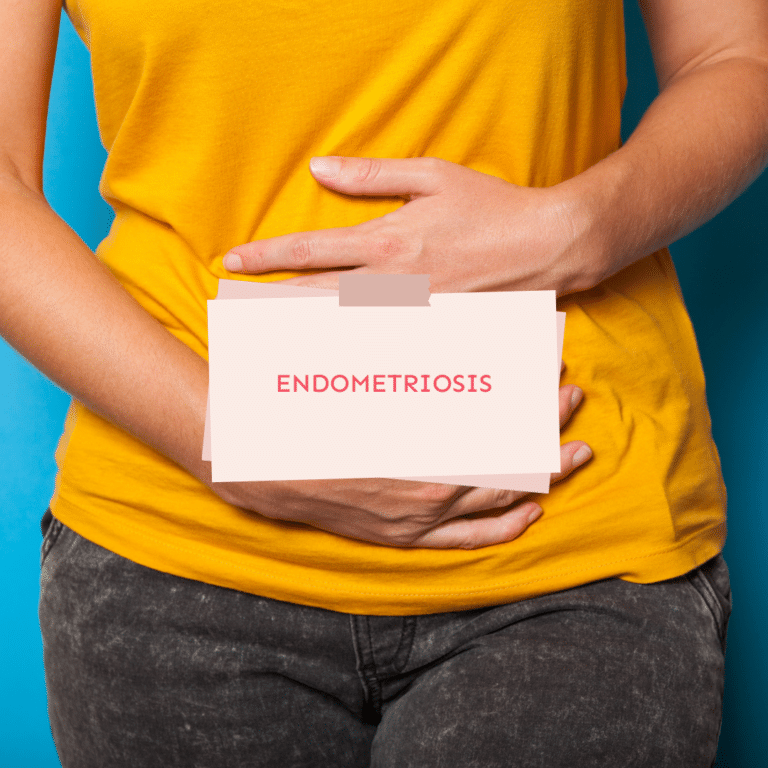 Endometriosis