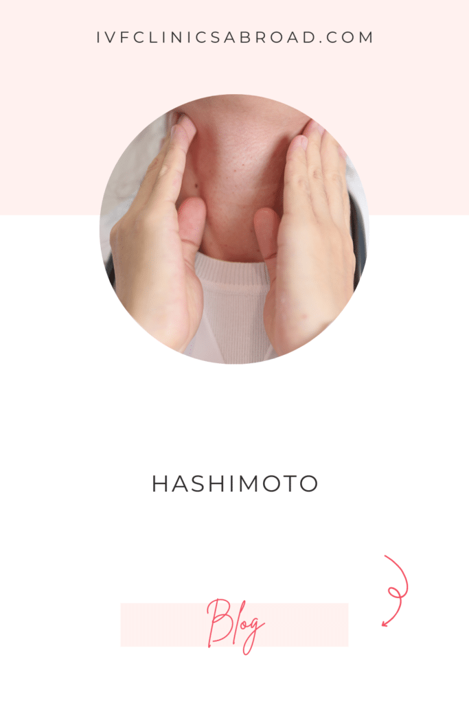 Trying to Conceive with Hypothyroidism / Hashimoto’s Thyroiditis: Causes, Diagnosis and Treatment 4 Hashimoto