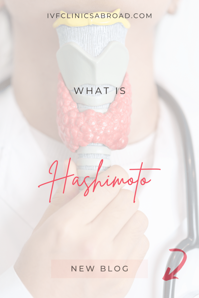 Trying to Conceive with Hypothyroidism / Hashimoto’s Thyroiditis: Causes, Diagnosis and Treatment 3 Hashimoto